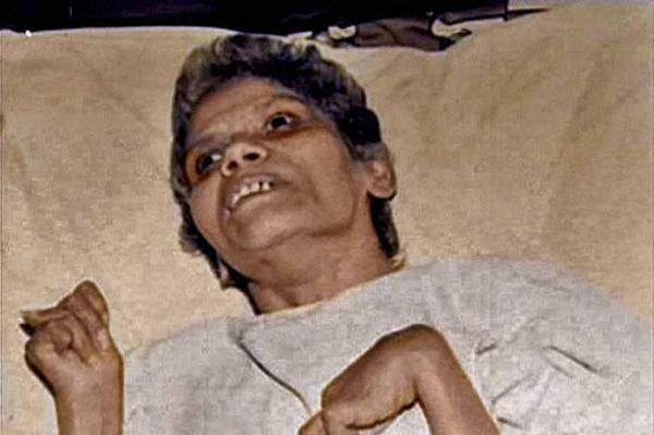 Kumar Gautan: An Open Letter From Aruna Shanbaug