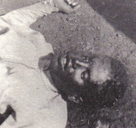 Effetti della civiltà italiana: giovane etiope ucciso dall'iprite (o gas mostarda).