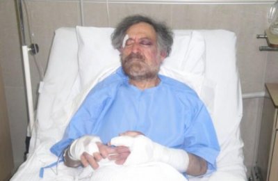 Foto di Ali Farzat dopo il ricovero in ospedale