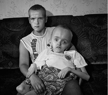 Victims of Černobyl'